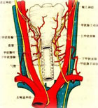 甲状腺肿大