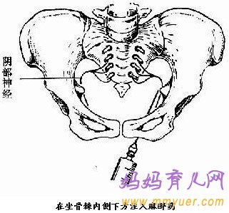 顺产侧切伤口护理方法及注意事项（图片）