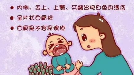 婴儿鹅口疮是怎么引起的