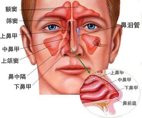 鼻子不通气怎么办，教你一个动作解决鼻塞