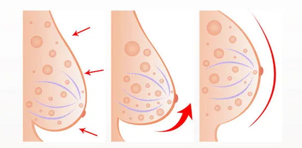 乳房变大