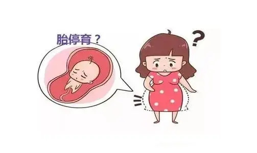 孕妈三个行为会引起胎停 看看你有吗？