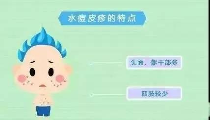 如何判断是不是水痘 怎么判断是水痘还是疱疹