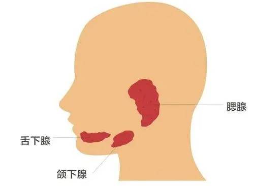 小儿腮腺炎能自愈吗