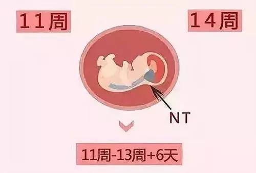 NT值能看男女吗 孕12周nt暗示男女吗？