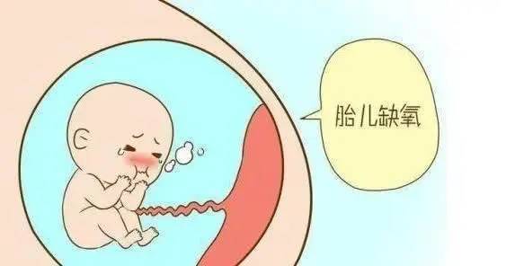 孕妇头疼剧烈是胎儿缺氧吗