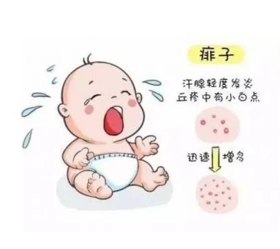 小孩热痱子有好的解决方案吗？