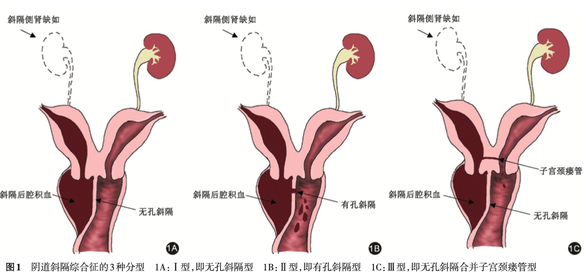 孕40周白带霉菌顺产了_白带清洁度3顺产_白带检查清洁四度