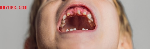 如何判断是不是手足口病？可以通过这三个特征