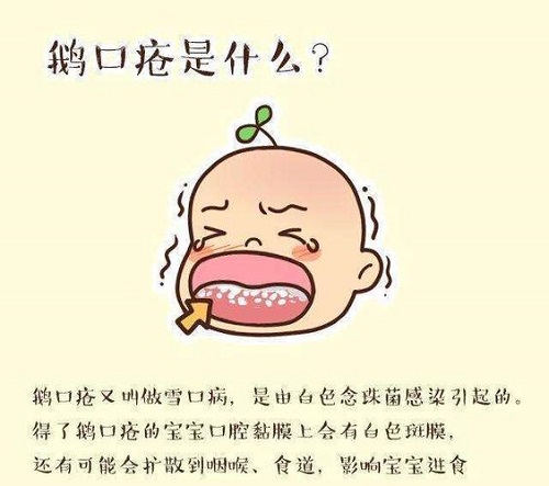 孩子长鹅口疮必须要用药吗？